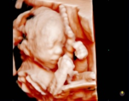 Ультразвукова діагностична система 